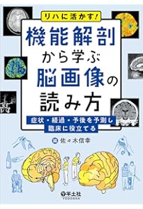 CD-ROMでレッスン 脳画像の読み方 第2版 | 石原健司 |本 | 通販 | Amazon